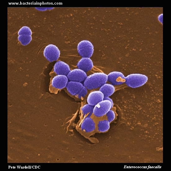 Enterococcus faecalis   
                         microscopy, gram-positive cocci